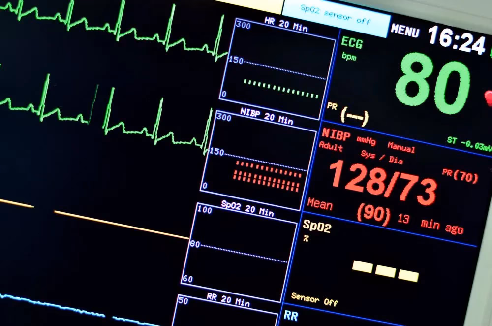 ¿Qué hacer en caso de frecuencia cardíaca baja?