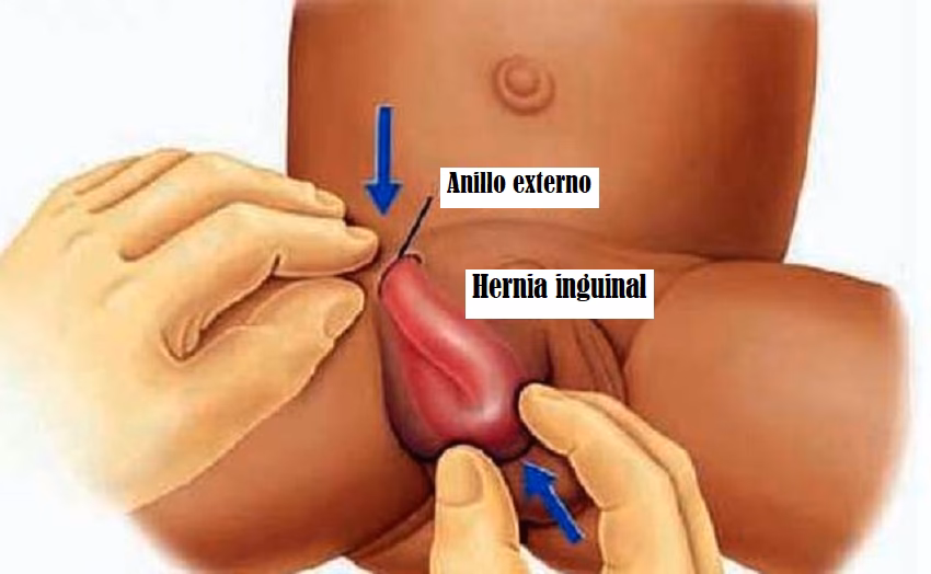 ¿Cuando un bulto es preocupante?