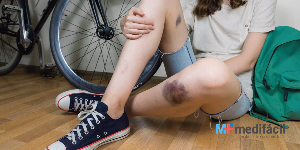 ¿Qué echarle a una herida para que sane rápido?