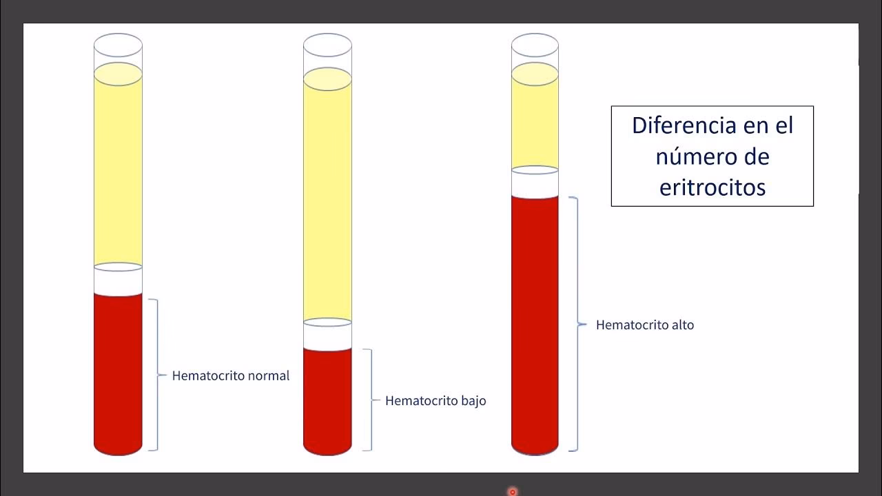 ¿Qué significa tener hemoglobina y hematocrito alto?