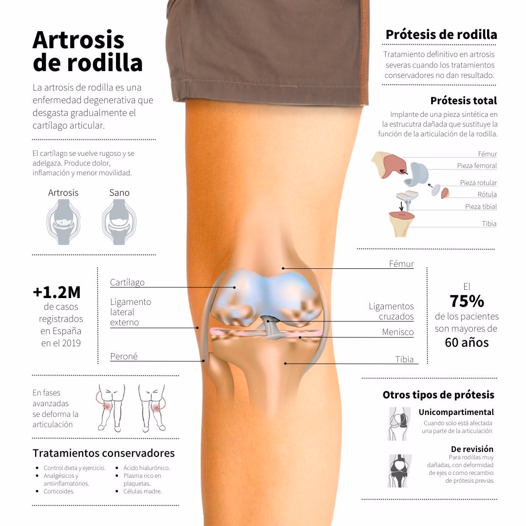 ¿Cuánto tarda en curarse una sobrecarga en la rodilla?