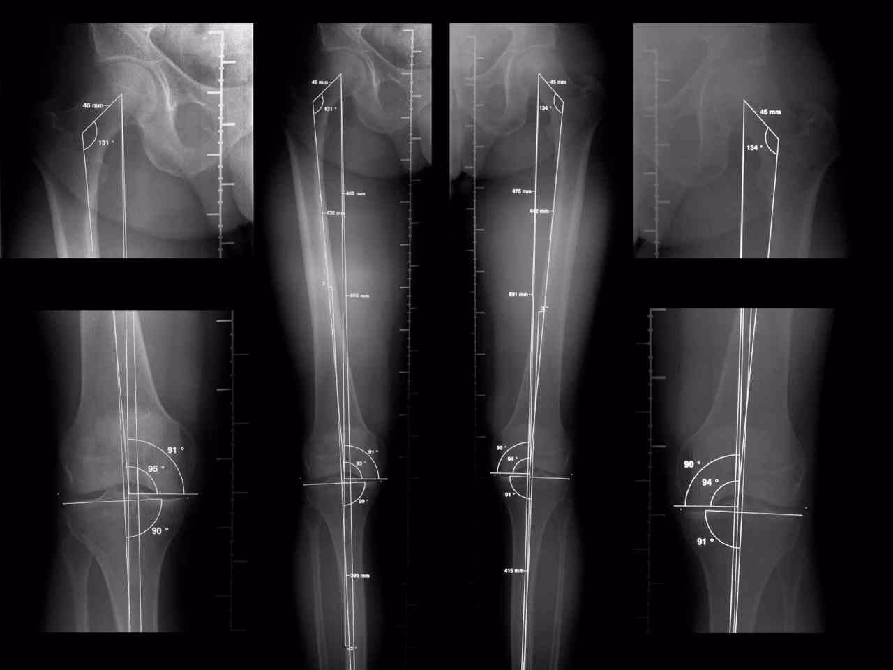 ¿Qué se puede ver en una telemetría?
