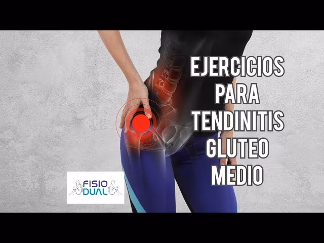 ¿Dónde duele la tendinitis del glúteo medio?
